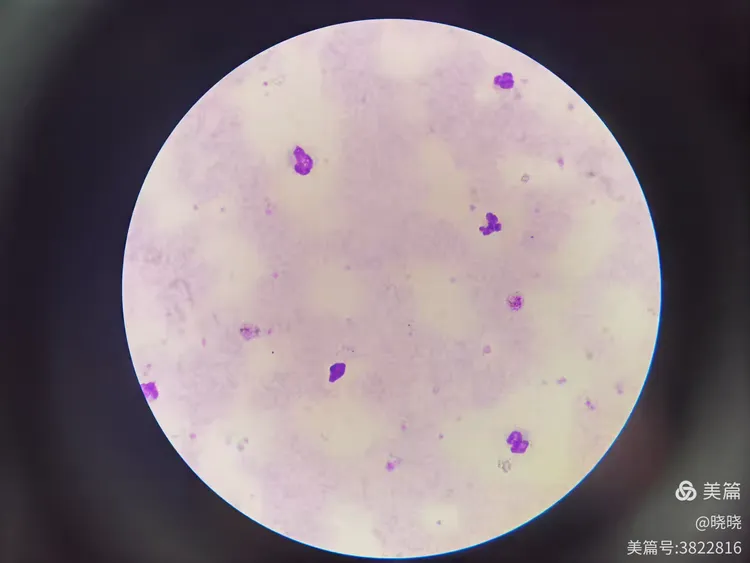 三种疟原虫厚膜染色法对比